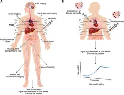 The Potential Application of Magnetic Nanoparticles for Liver Fibrosis Theranostics